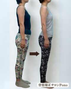 下半身ライン ビフォーアフター