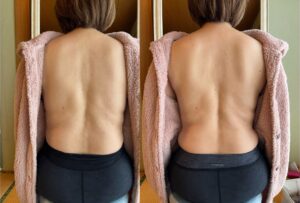 ウエストくびれ ビフォーアフター