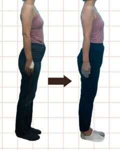 お腹周り ビフォーアフター